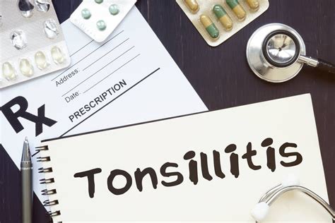 Tonsillitis: Signs, Symptoms, Causes, and Treatment