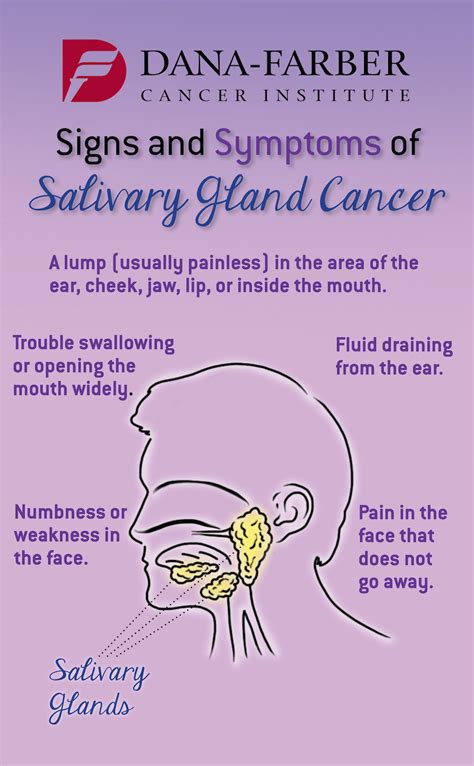 Salivary Gland Cancer: What are the Symptoms? | Dana-Farber