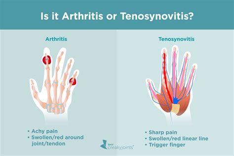 Flexor Tenosynovitis Causes