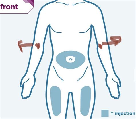 Xolair Injection Site : r/urticaria