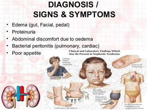 Signs And Symptoms Of Nephrotic Syndrome