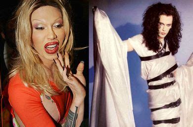 Pete Burns before and after plastic surgery 1 | Celebrity plastic ...