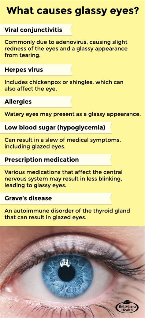 10 Causes of Glassy Eyes: Treatment and Prevention | Alternative health ...