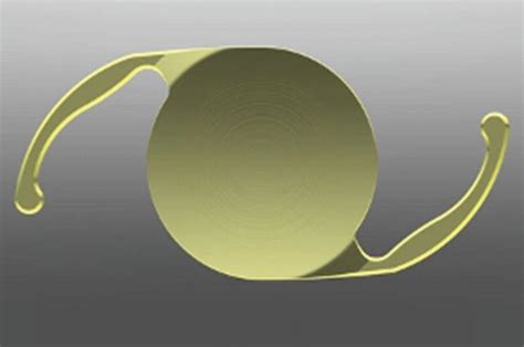 Alcon PanOptix IOL Denver | Cutarelli Vision | Cataract Lens Implant