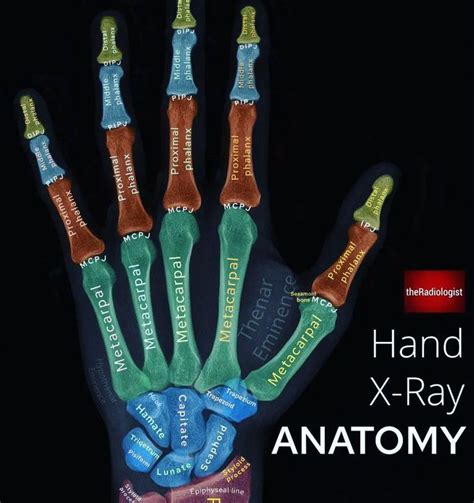 Hand X-ray Anatomy - MEDizzy