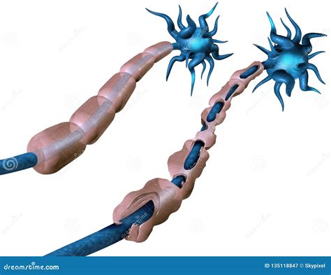 Multiple Sclerosis stock illustration. Illustration of nerve - 135118847