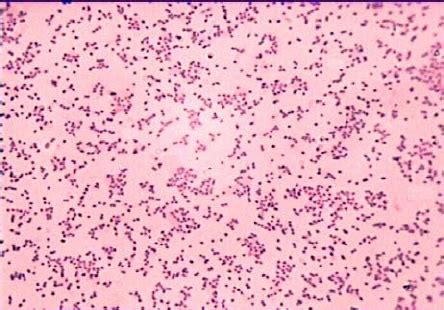 Microscopic view of B. pertussis strain 134. Gram- staining, 1000X ...