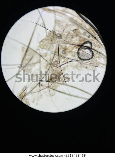 Notoedres Cati Under Microscope Notoedric Mange Stock Photo 2219489459 ...