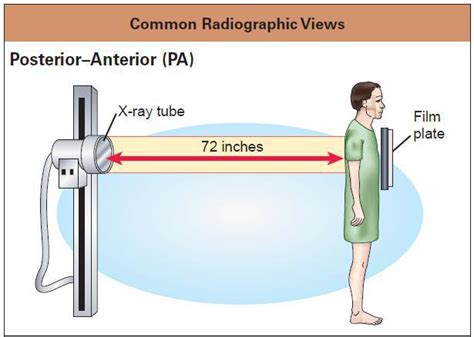 Interpreting A Chest X-Ray - Stepwards