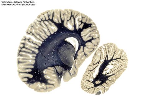 The Dolphin Brain Atlas at Michigan State University