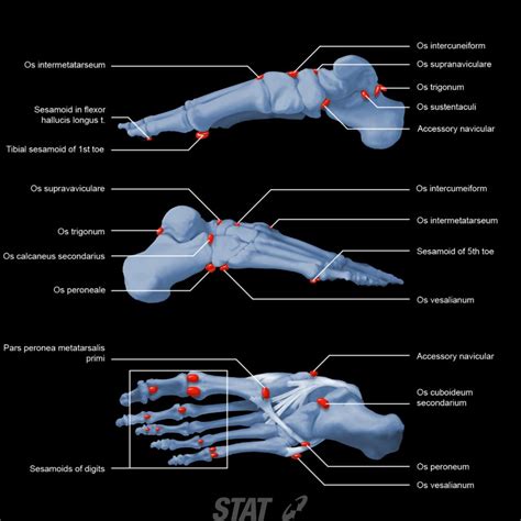 MRI atlas