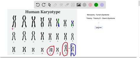 ⏩SOLVED:Abnormalities in chromosome number give rise to diseases of ...