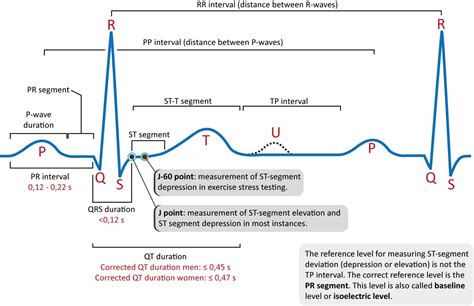 ECG interpretation: Characteristics of the normal ECG (P-wave, QRS complex, ST segment, T-wave ...