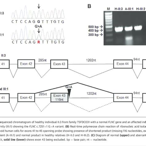 (PDF) FLNC Gene Splice Mutations Cause Dilated Cardiomyopathy