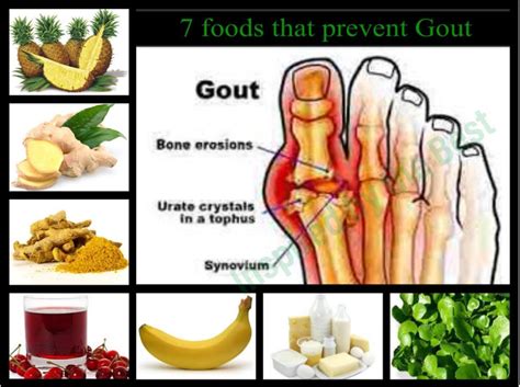 7 Foods that prevent gout | Foods that cause gout, Gout prevention