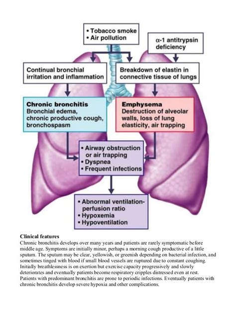 chronic bronchitis causes - DriverLayer Search Engine