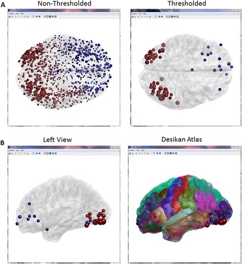 Example of the nodes visualization control. A. All nodes are showed ...