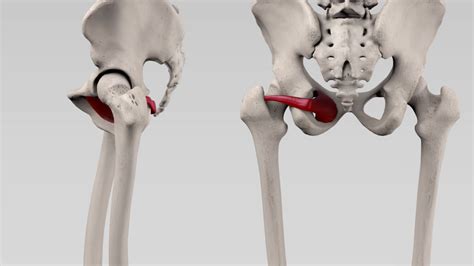 Musculus obturator internus - DocCheck