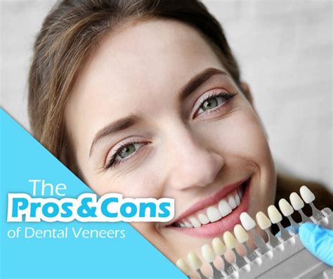 Pros and Cons of Dental Veneers