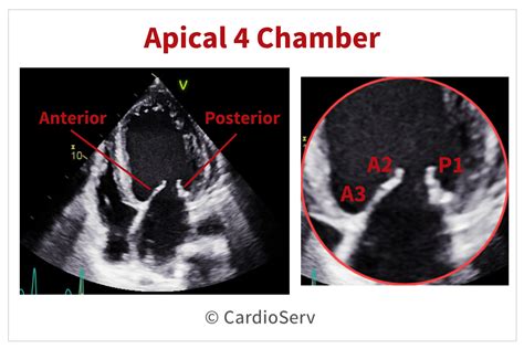 Finally... Mitral Valve Orientation Explained! Cardioserv