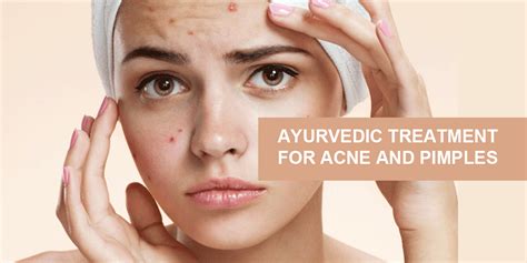 Ayurvedic treatment for Acne Vulgaris - Dr. Brahmanand Nayak