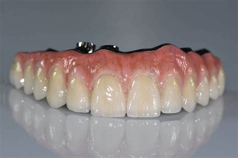 Hybrid Products • Triad Dental Studio