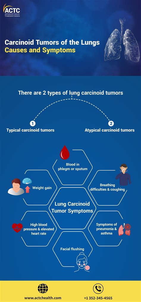 Lung Carcinoid Tumor Causes and Symptoms | ACTC