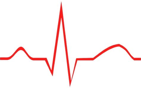 medicine: EKG beginner