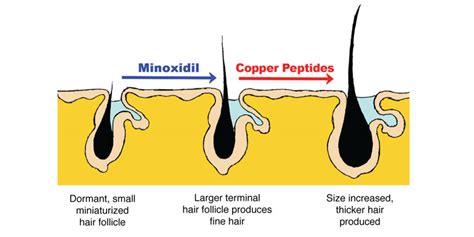 hair loss: Copper Peptides Hair Loss