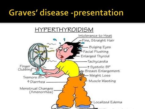 Grave’s disease