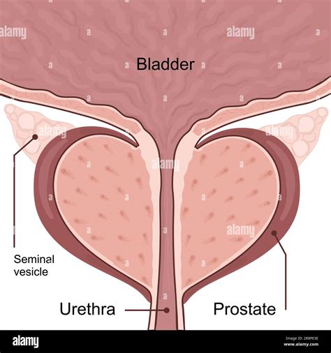 Medical diagram of healthy prostate with bladder. vector illustration ...