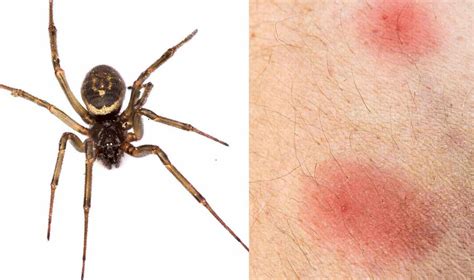 what does a spider bite look like - what does a spider bite look like