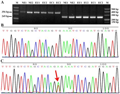 Analysis of the oncogene BRAF mutation and the correlation of the expression of wild-type BRAF ...