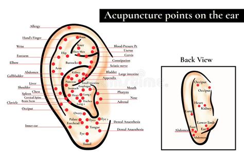 Reflex Zones On The Ear. Acupuncture Points On The Ear. Map Of A Stock Vector - Image: 70357554