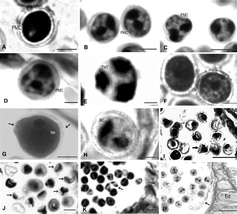 Microsporogenesis and abnormal development during the process. A. The... | Download Scientific ...