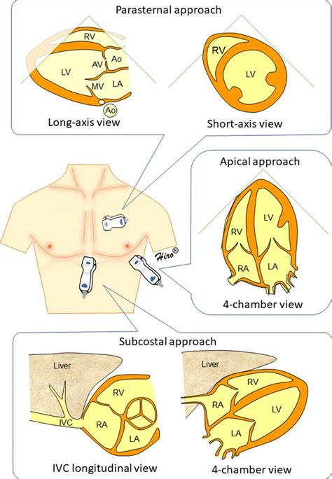 Basic cardiac #POCUS views image acquisition flash cards. Courtesy of ...