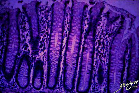 Crypts of Lieberkuhn of the Colon | Art In Anatomy