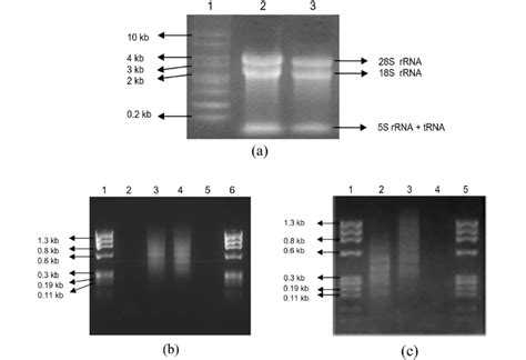 a Agarose-formaldehyde gel electrophoresis showing total RNA isolated... | Download Scientific ...