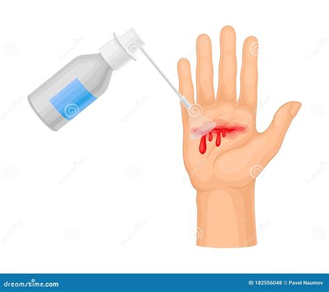 Hand with Wound Streaming Blood Cleaning with Pharmaceutical Substance ...