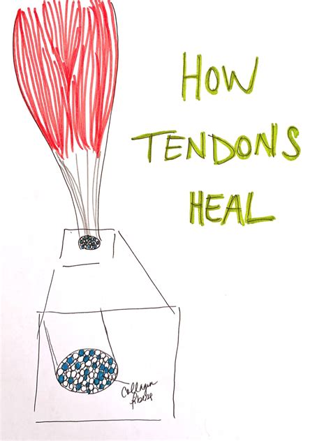 How to Heal Tendonitis without Sacrificing your Workouts — Chelsea ...