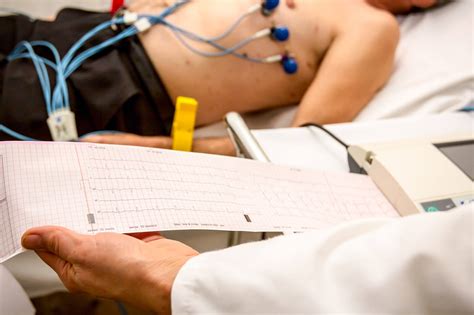 12 Lead Electrocardiogram (ECG) in Australia - Dr Arthur Nasis