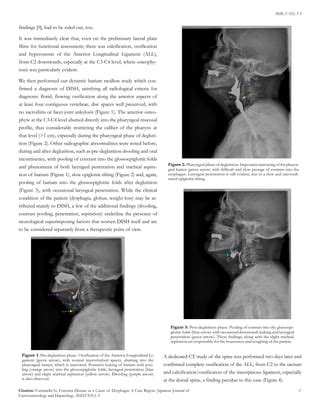 Forestier Disease as a Cause of Dysphagia: A Case Report | PDF