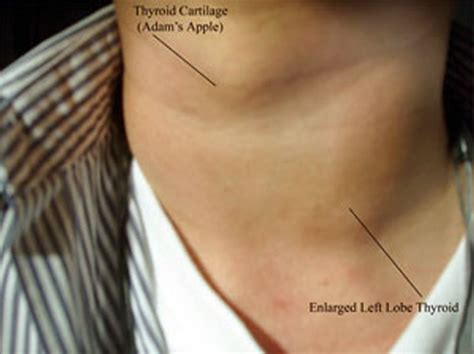 Pin on Thyroid Disorders: Treating the Root Cause