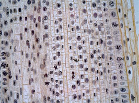 Mitosis Under Microscope Labeled