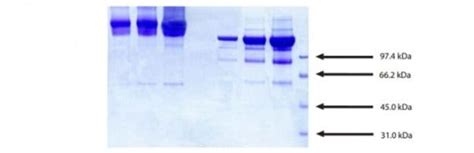 Native Human alpha 2 Macroglobulin protein (ab285821) | Abcam