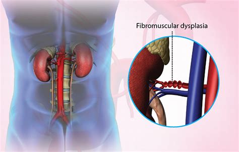 Health Condition : Symptoms, Causes, Treatment and More