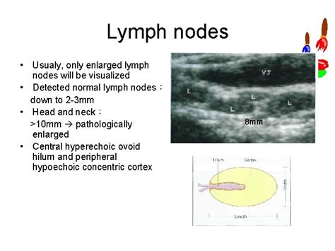 Lymph Nodes Differential Diagnosis in Ultrasound Imaging p