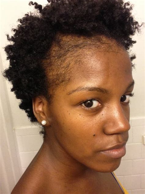 Help! My Edges Are Starting To Thin--What Could Be The Cause? - Black Hair Information