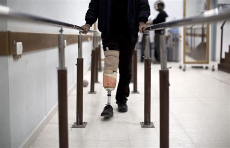 Dubai to make artificial limbs for $110 - Arabian Business: Latest News ...