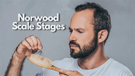 Norwood Scale Stages: Understanding Hair Loss Progression